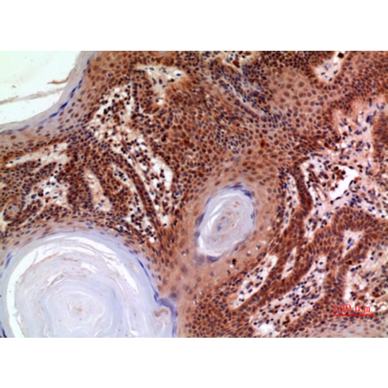 Immunohistochemistry - Anti-A2M Antibody (C30109) - Antibodies.com
