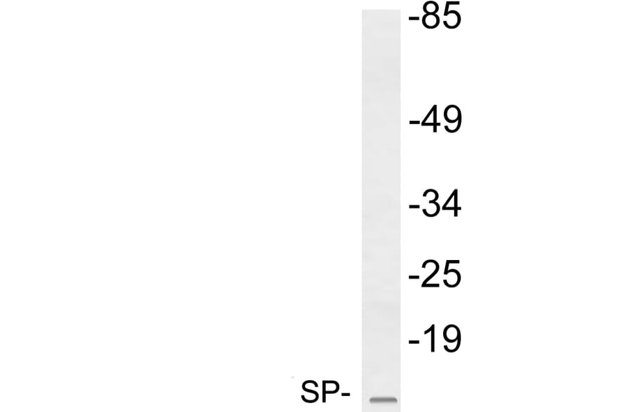 Western Blot - Anti-SP Antibody (R12-2365) - Antibodies.com