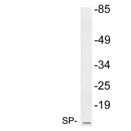 Western Blot - Anti-SP Antibody (R12-2365) - Antibodies.com