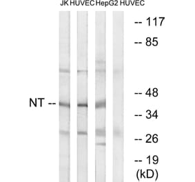 Western Blot - Anti-NT Antibody (C17036) - Antibodies.com