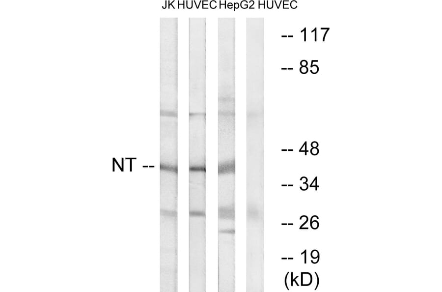 Western Blot - Anti-NT Antibody (C17036) - Antibodies.com