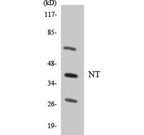 Western Blot - Anti-NT Antibody (R12-3110) - Antibodies.com