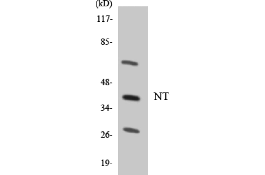 Western Blot - Anti-NT Antibody (R12-3110) - Antibodies.com