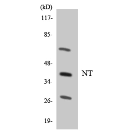 Western Blot - Anti-NT Antibody (R12-3110) - Antibodies.com