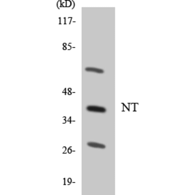 Western Blot - Anti-NT Antibody (R12-3110) - Antibodies.com
