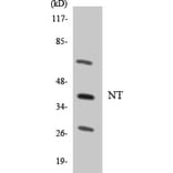 Western Blot - Anti-NT Antibody (R12-3110) - Antibodies.com