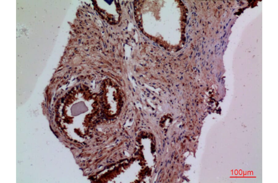 Immunohistochemistry - Anti-F3 Antibody (C30125) - Antibodies.com