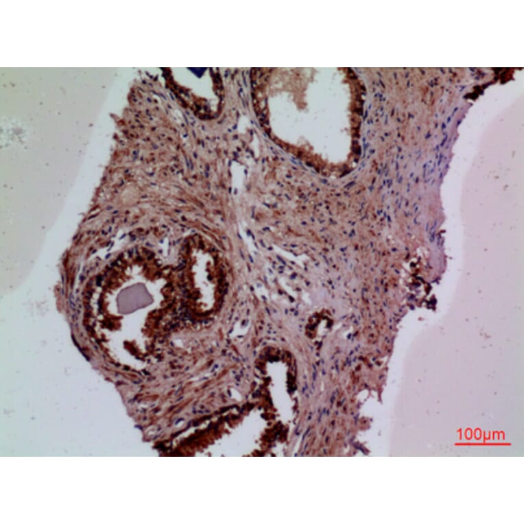 Immunohistochemistry - Anti-F3 Antibody (C30125) - Antibodies.com