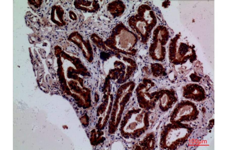 Immunohistochemistry - Anti-F3 Antibody (C30125) - Antibodies.com