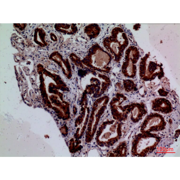 Immunohistochemistry - Anti-F3 Antibody (C30125) - Antibodies.com