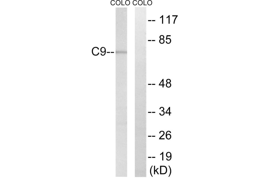 Western Blot - Anti-C9 Antibody (C15224) - Antibodies.com