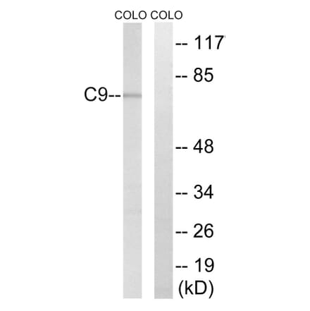 Western Blot - Anti-C9 Antibody (C15224) - Antibodies.com
