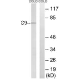 Western Blot - Anti-C9 Antibody (C15224) - Antibodies.com