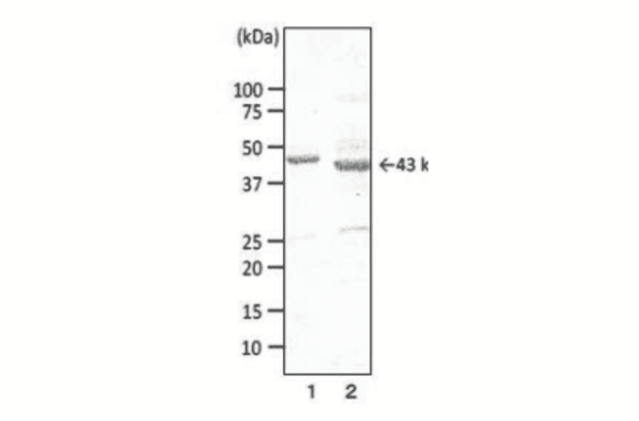 Western blotting of porin in extract of Campylobacter with MAb (cj-01).