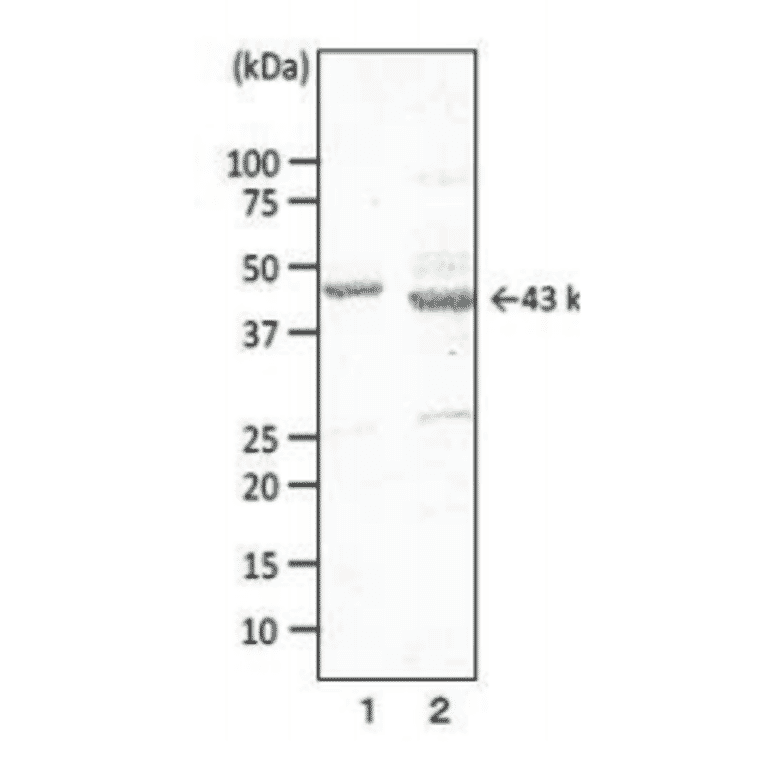 Western blotting of porin in extract of Campylobacter with MAb (cj-01).