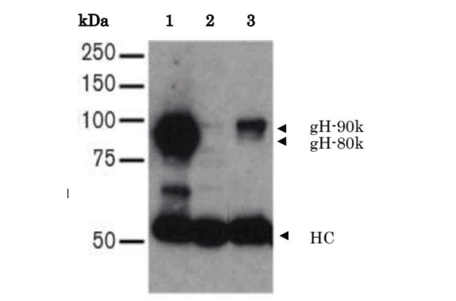 Immunoprecipitation of HHV7 gH in the lysate of HHV7 infected-SupT-1 cells.