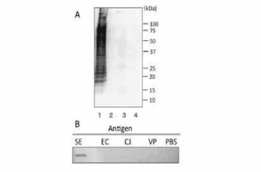 Reactivities of MAb (se-01) with several food poisoning bacteria in Western blotting (A) and slot blot test (B).