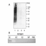 Reactivities of MAb (se-01) with several food poisoning bacteria in Western blotting (A) and slot blot test (B).