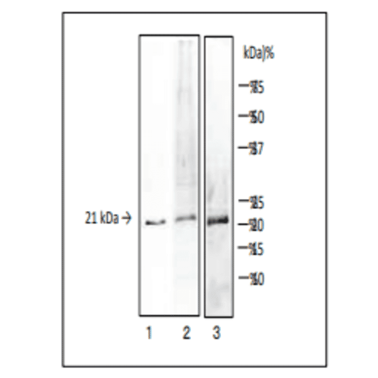 Detection of V. parahaemolyticus TDH and TRH by Western blotting with MAb (vp-01)