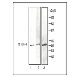 Detection of V. parahaemolyticus TDH and TRH by Western blotting with MAb (vp-01)