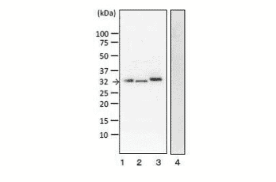 Detection of VT1 and VT2 by Western blotting with monoclonal antibody (vero-01).