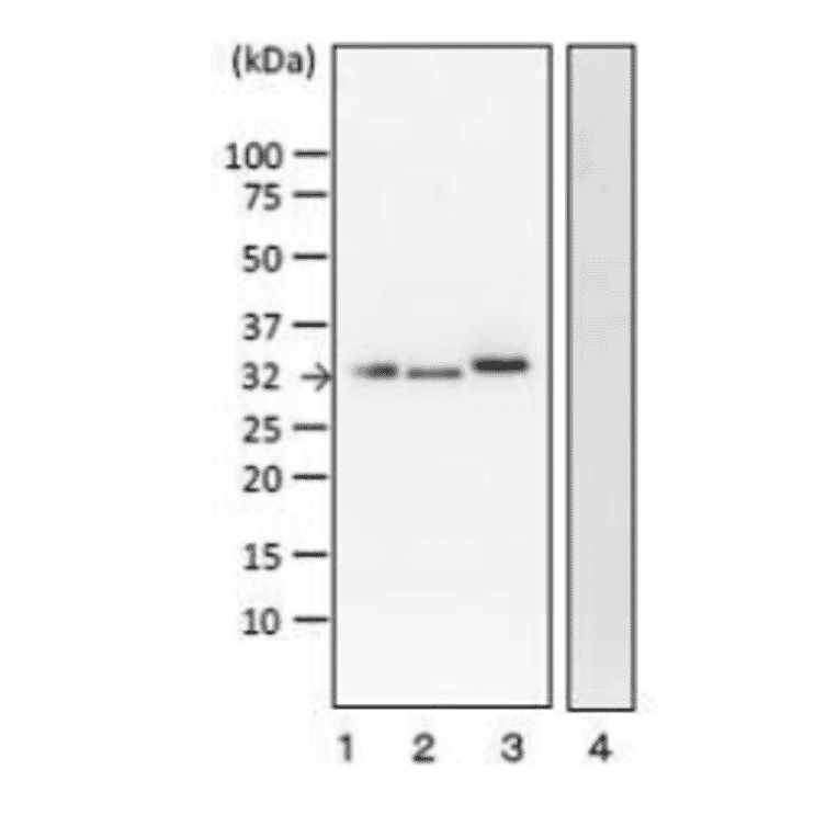 Detection of VT1 and VT2 by Western blotting with monoclonal antibody (vero-01).