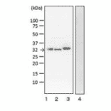 Detection of VT1 and VT2 by Western blotting with monoclonal antibody (vero-01).