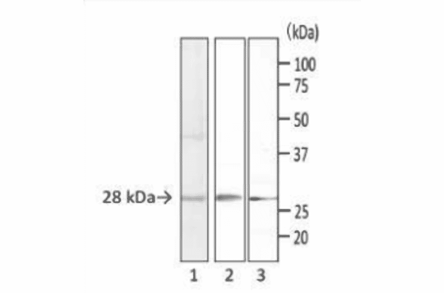 Detection of S. aureus enterotoxins by Western blotting with monoclonal antibody (MAb sa-01).