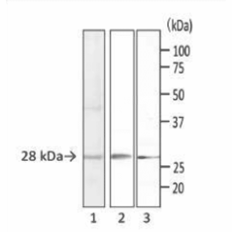 Detection of S. aureus enterotoxins by Western blotting with monoclonal antibody (MAb sa-01).