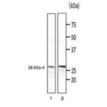 Detection of phospholipase C (PC-PLC) of B. cereus by Western blotting with monoclonal antibody (bc-01).