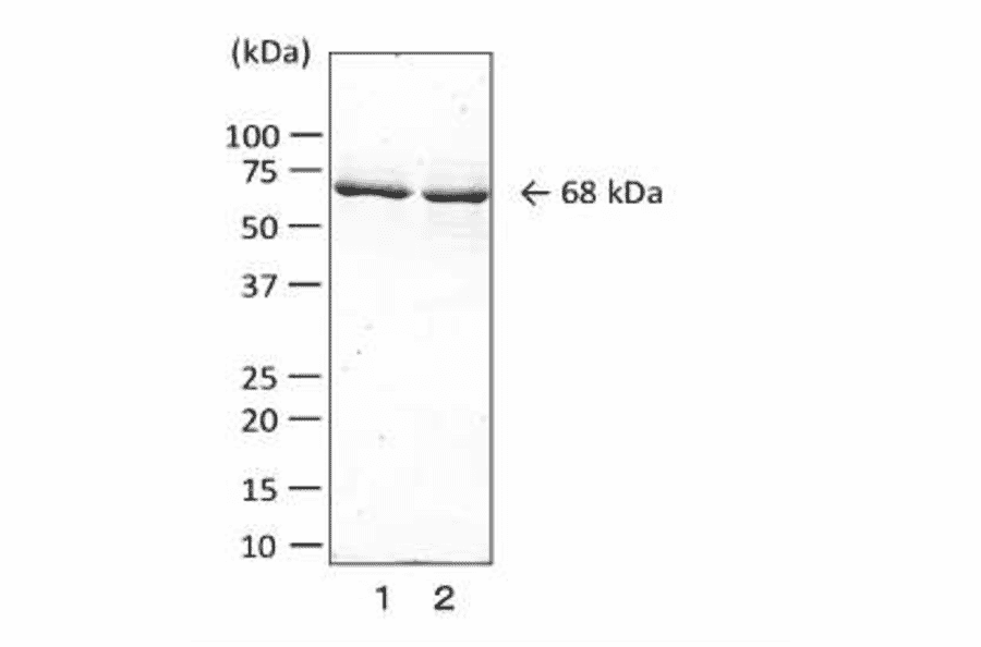 Detection of collagenase of C. perfringens by Western blotting with monoclonal antibody (MAb cp-02).