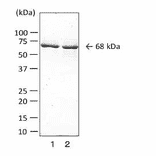 Detection of collagenase of C. perfringens by Western blotting with monoclonal antibody (MAb cp-02).
