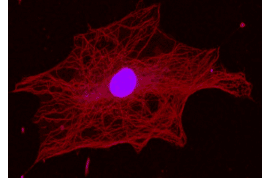 Immunofluorescence staining of alpha Tubulin