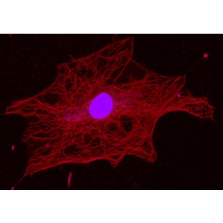 Immunofluorescence staining of alpha Tubulin