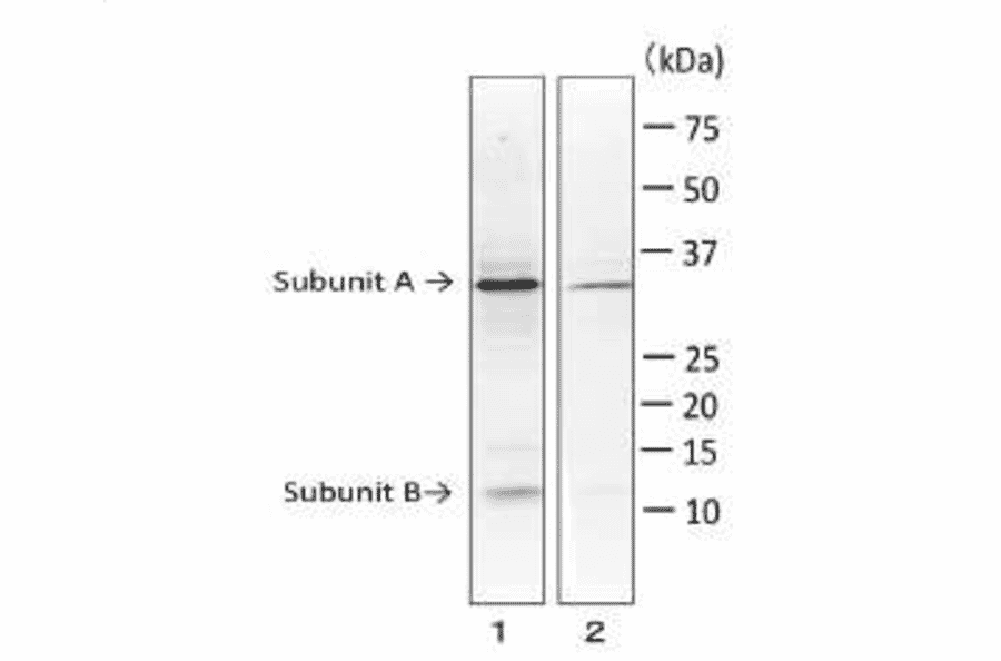 Detection of LT toxin in extract of E. coli ETEC strain by Western blotting with monoclonal antibody (MAb ec-01).