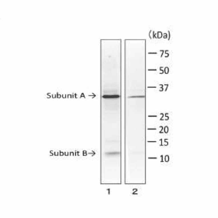Detection of LT toxin in extract of E. coli ETEC strain by Western blotting with monoclonal antibody (MAb ec-01).