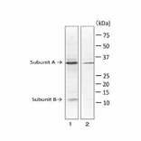 Detection of LT toxin in extract of E. coli ETEC strain by Western blotting with monoclonal antibody (MAb ec-01).