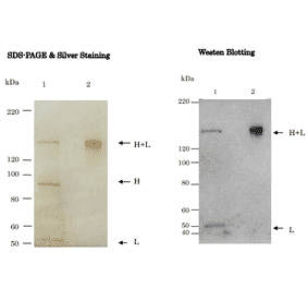 Figure. Western Blot analysis of Tetanus Toxin with anti-Tetanus Toxin antibody (TH11)