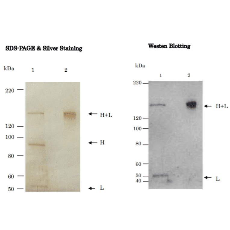 Figure. Western Blot analysis of Tetanus Toxin with anti-Tetanus Toxin antibody (TH11)