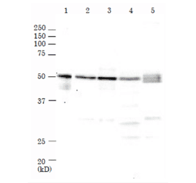 Western Blot of Rad52 in mammalian cells. M: Marker proteins. Lane 1: Recombinant human Rad52 protein (0.2ng). Lane 2: HeLa cell extrat (17µg). Lane 3: MCF7 cell extract (27µg). Lane 4: NIH3T3 cell extract (20µg). Lane 5: CHO cell extract (21µg). The samples were separated by electrophoresis on 10% SDS-PAGE and blotted onto PVDF membrane. Anti-Rad52 Antibody was used at 1:1,000 dilution and Goat Anti-Rabbit IgG Antibody (HRP) was used as a secondary at 1:10,000 dilution. Molecular mass of human Rad52 protein is 47 kDa.