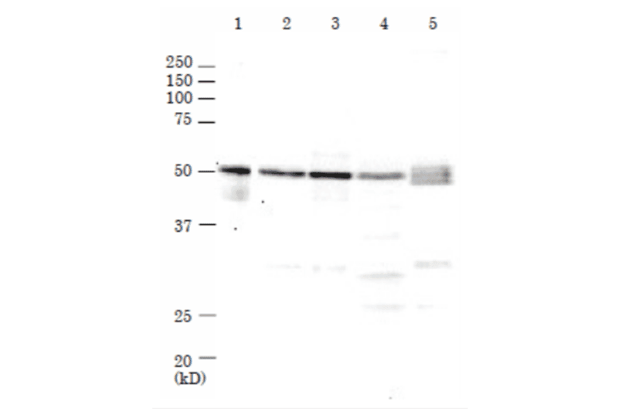 Western Blot of Rad52 in mammalian cells. M: Marker proteins. Lane 1: Recombinant human Rad52 protein (0.2ng). Lane 2: HeLa cell extrat (17µg). Lane 3: MCF7 cell extract (27µg). Lane 4: NIH3T3 cell extract (20µg). Lane 5: CHO cell extract (21µg). The samples were separated by electrophoresis on 10% SDS-PAGE and blotted onto PVDF membrane. Anti-Rad52 Antibody was used at 1:1,000 dilution and Goat Anti-Rabbit IgG Antibody (HRP) was used as a secondary at 1:10,000 dilution. Molecular mass of human Rad52 protein is 47 kDa.