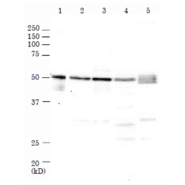 Western Blot of Rad52 in mammalian cells. M: Marker proteins. Lane 1: Recombinant human Rad52 protein (0.2ng). Lane 2: HeLa cell extrat (17µg). Lane 3: MCF7 cell extract (27µg). Lane 4: NIH3T3 cell extract (20µg). Lane 5: CHO cell extract (21µg). The samples were separated by electrophoresis on 10% SDS-PAGE and blotted onto PVDF membrane. Anti-Rad52 Antibody was used at 1:1,000 dilution and Goat Anti-Rabbit IgG Antibody (HRP) was used as a secondary at 1:10,000 dilution. Molecular mass of human Rad52 protein is 47 kDa.