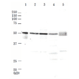 Western Blot of Rad52 in mammalian cells. M: Marker proteins. Lane 1: Recombinant human Rad52 protein (0.2ng). Lane 2: HeLa cell extrat (17µg). Lane 3: MCF7 cell extract (27µg). Lane 4: NIH3T3 cell extract (20µg). Lane 5: CHO cell extract (21µg). The samples were separated by electrophoresis on 10% SDS-PAGE and blotted onto PVDF membrane. Anti-Rad52 Antibody was used at 1:1,000 dilution and Goat Anti-Rabbit IgG Antibody (HRP) was used as a secondary at 1:10,000 dilution. Molecular mass of human Rad52 protein is 47 kDa.