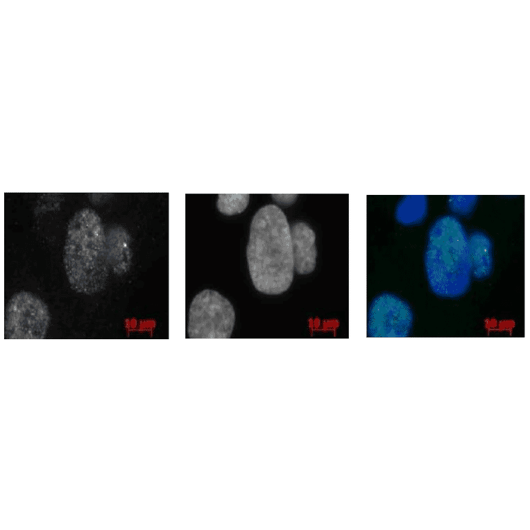 Western blot of Rad52 in Rat cells. Lane 1: Human MCF-7 cell lysate (16µg). Lane 2: Rat PC-12 cell (40µg). Proteins in the lysates were separated on SDS-PAGE (12.5%) and electro-blotted to PVDF membrane overnight. The blot was blocked with 5% skim milk. Anti-Rad52 Antibody was used at 1:1,000 dilution and Goat Anti-Rabbit IgG Antibody (HRP) was used as a secondary at 1:10,000 dilution.