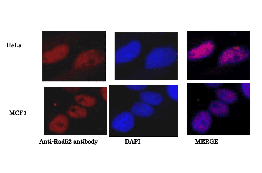 Immunoprecipitation of Rad52 from human cell lysate. 1. Add 10µg of Anti-Rad52 Antibody and 50µg of Dynabeads protein A. 2. Incubate for 10 min at room temperature, wash and resuspend in 100µl of the same buffer. 3. Add 100µl (300µg in PBS) lysate of human MCF7 cells. 4. Incubate for and collect the immunocomplex with Dynabeeds magnetic apparatus. 5. Elute the immunocomplex and analyze the presence of Rad52 in the supernatant (Lane 2) and the eluate (Lane 1) by western blotting with Anti-Rad52 Antibody. 6. Goat Anti-Rabbit IgG Antibody (HRP) was used as a secondary at 1:10,000 dilution. Lane 3 is western blot of MCF’ lysate (16µg).