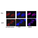 Immunoprecipitation of Rad52 from human cell lysate. 1. Add 10µg of Anti-Rad52 Antibody and 50µg of Dynabeads protein A. 2. Incubate for 10 min at room temperature, wash and resuspend in 100µl of the same buffer. 3. Add 100µl (300µg in PBS) lysate of human MCF7 cells. 4. Incubate for and collect the immunocomplex with Dynabeeds magnetic apparatus. 5. Elute the immunocomplex and analyze the presence of Rad52 in the supernatant (Lane 2) and the eluate (Lane 1) by western blotting with Anti-Rad52 Antibody. 6. Goat Anti-Rabbit IgG Antibody (HRP) was used as a secondary at 1:10,000 dilution. Lane 3 is western blot of MCF’ lysate (16µg).