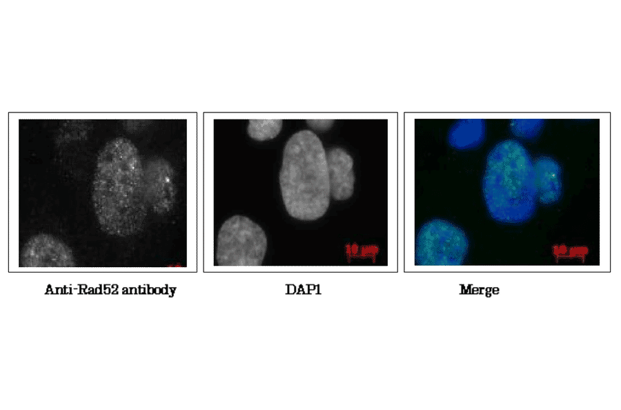 Detection of Ra52 protein in human fibroblast cell line, GM0637 by immunofluorescence staining. Cells were fixed with 4% paraformaldehyde in 1x PBS for 10 min, washed 3 times with PBS for 3 min, permealized by treatment with solution containing 1% SDS and 0.5% Triton for 10 min, washed 3 times with PBS for 3 min, incubated with Anti-Rad52 Antibody for 30 min at 37°C, washed 3 times with PBS for 3 min, incubated with secondary antibody for 30 min at 37°C, washed 3 times with PBS for 3 min, stained with DAPI for 1 min and mounted. Photographed with confocal microscope. Anti-Rad52 Antibody was used at 1:1,000 dilution. Goat Anti-Rabbit IgG Antibody (Alexa 488) was used at 1:2,000 dilution.