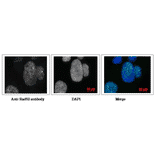 Detection of Ra52 protein in human fibroblast cell line, GM0637 by immunofluorescence staining. Cells were fixed with 4% paraformaldehyde in 1x PBS for 10 min, washed 3 times with PBS for 3 min, permealized by treatment with solution containing 1% SDS and 0.5% Triton for 10 min, washed 3 times with PBS for 3 min, incubated with Anti-Rad52 Antibody for 30 min at 37°C, washed 3 times with PBS for 3 min, incubated with secondary antibody for 30 min at 37°C, washed 3 times with PBS for 3 min, stained with DAPI for 1 min and mounted. Photographed with confocal microscope. Anti-Rad52 Antibody was used at 1:1,000 dilution. Goat Anti-Rabbit IgG Antibody (Alexa 488) was used at 1:2,000 dilution.
