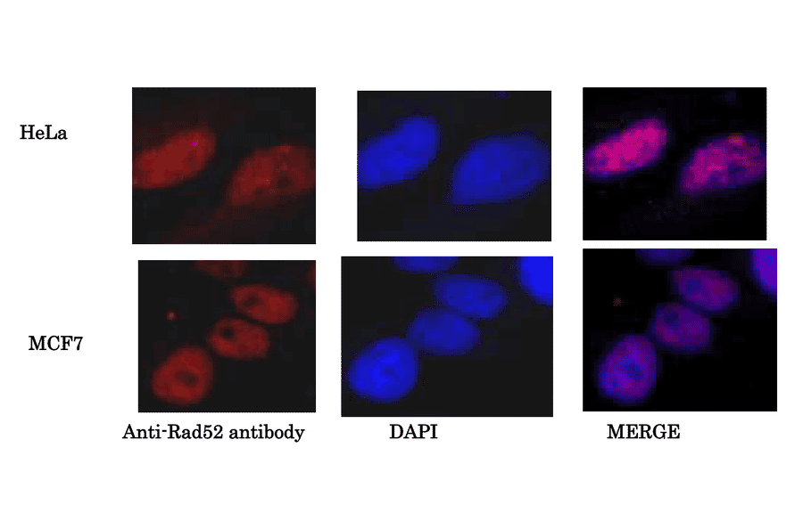 Detection of Rad52 protein in HeLa cells and MCF7 cells by immunofluorescence staining. Fixed with 4% paraformaldehyde, and permeabilized with 0.25% TritonX-100. DNA was stained with DAPI. Anti-Rad52 Antibody was used at 1:1,000 dilution and Goat Anti-Rabbit IgG Antibody (Alexa 488) was used as a secondary at 1:1,000 dilution.