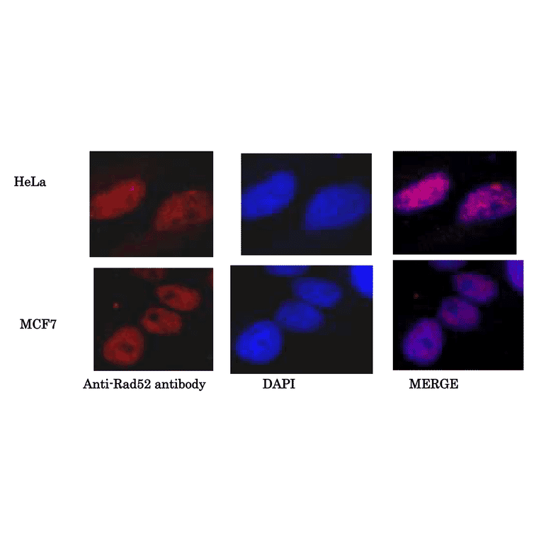 Detection of Rad52 protein in HeLa cells and MCF7 cells by immunofluorescence staining. Fixed with 4% paraformaldehyde, and permeabilized with 0.25% TritonX-100. DNA was stained with DAPI. Anti-Rad52 Antibody was used at 1:1,000 dilution and Goat Anti-Rabbit IgG Antibody (Alexa 488) was used as a secondary at 1:1,000 dilution.